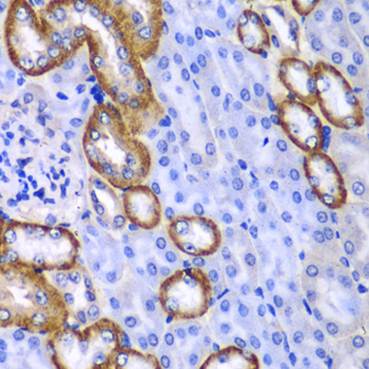 Immunohistochemistry of paraffin-embedded Mouse kidney using MYO1C Polyclonal Antibody at dilution of  1:100 (40x lens).