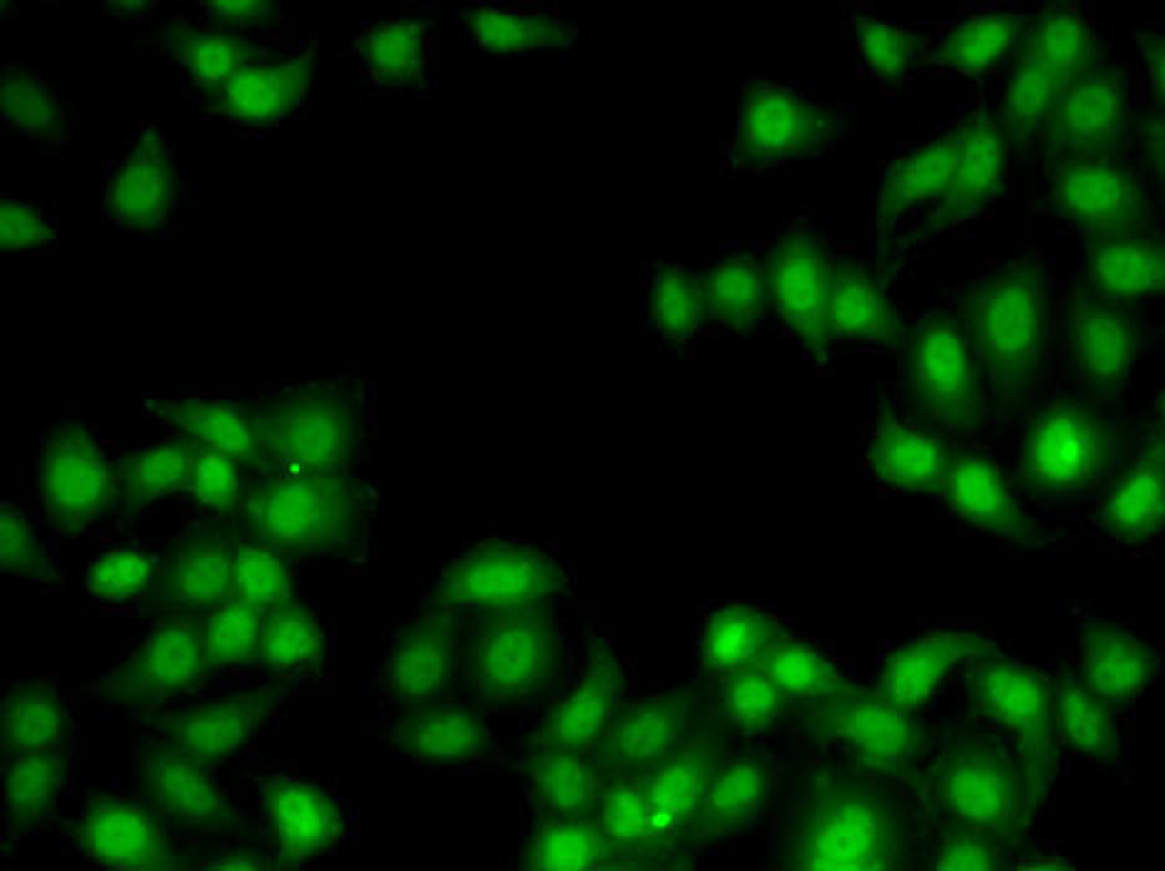 Immunofluorescence analysis of MCF7 cells using MYO1C Polyclonal Antibody