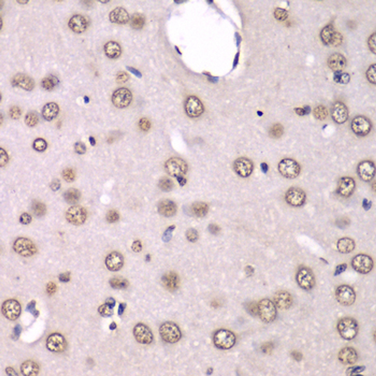 Immunohistochemistry of paraffin-embedded Rat brain using HNRNPM Polyclonal Antibody at dilution of  1:100 (40x lens).