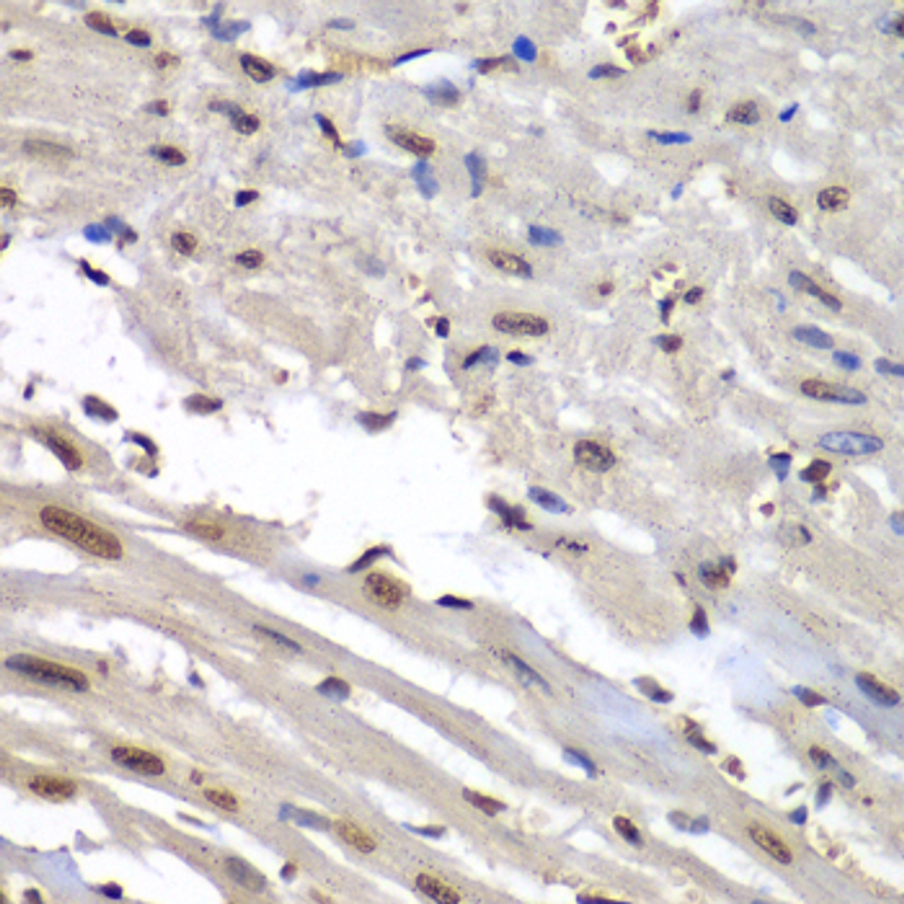 Immunohistochemistry of paraffin-embedded Mouse heart using HNRNPM Polyclonal Antibody at dilution of  1:100 (40x lens).
