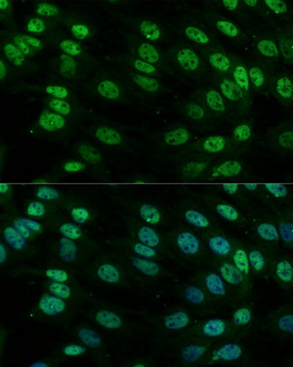 Immunofluorescence analysis of C6 cells using HNRNPM Polyclonal Antibody at dilution of  1:100. Blue: DAPI for nuclear staining.