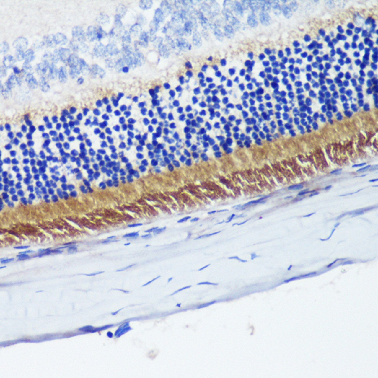Immunohistochemistry of paraffin-embedded Rat retina using PDE6B Polyclonal Antibody at dilution of  1:200 (40x lens).