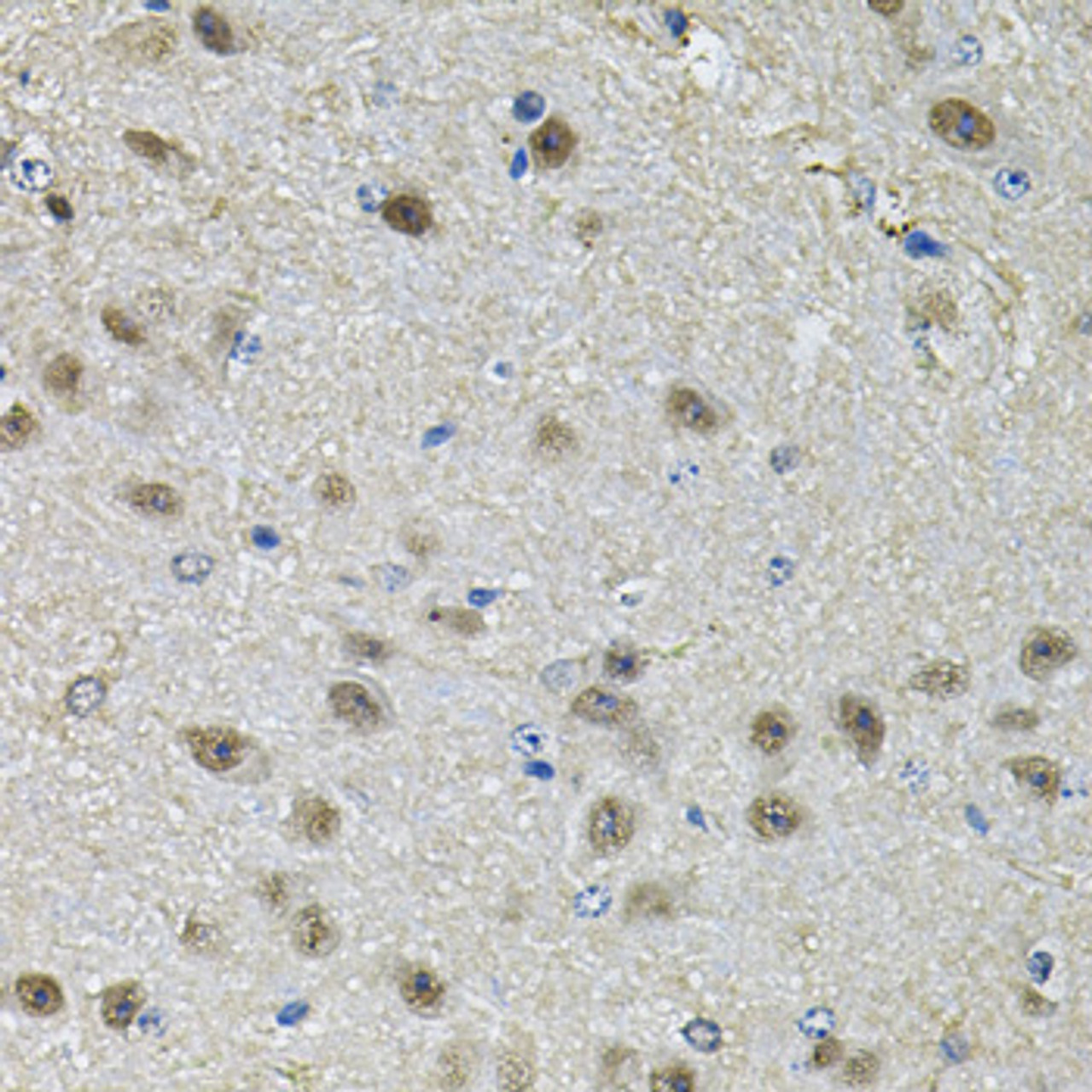 Immunohistochemistry of paraffin-embedded Mouse brain using PPID Polyclonal Antibody at dilution of  1:100 (40x lens).