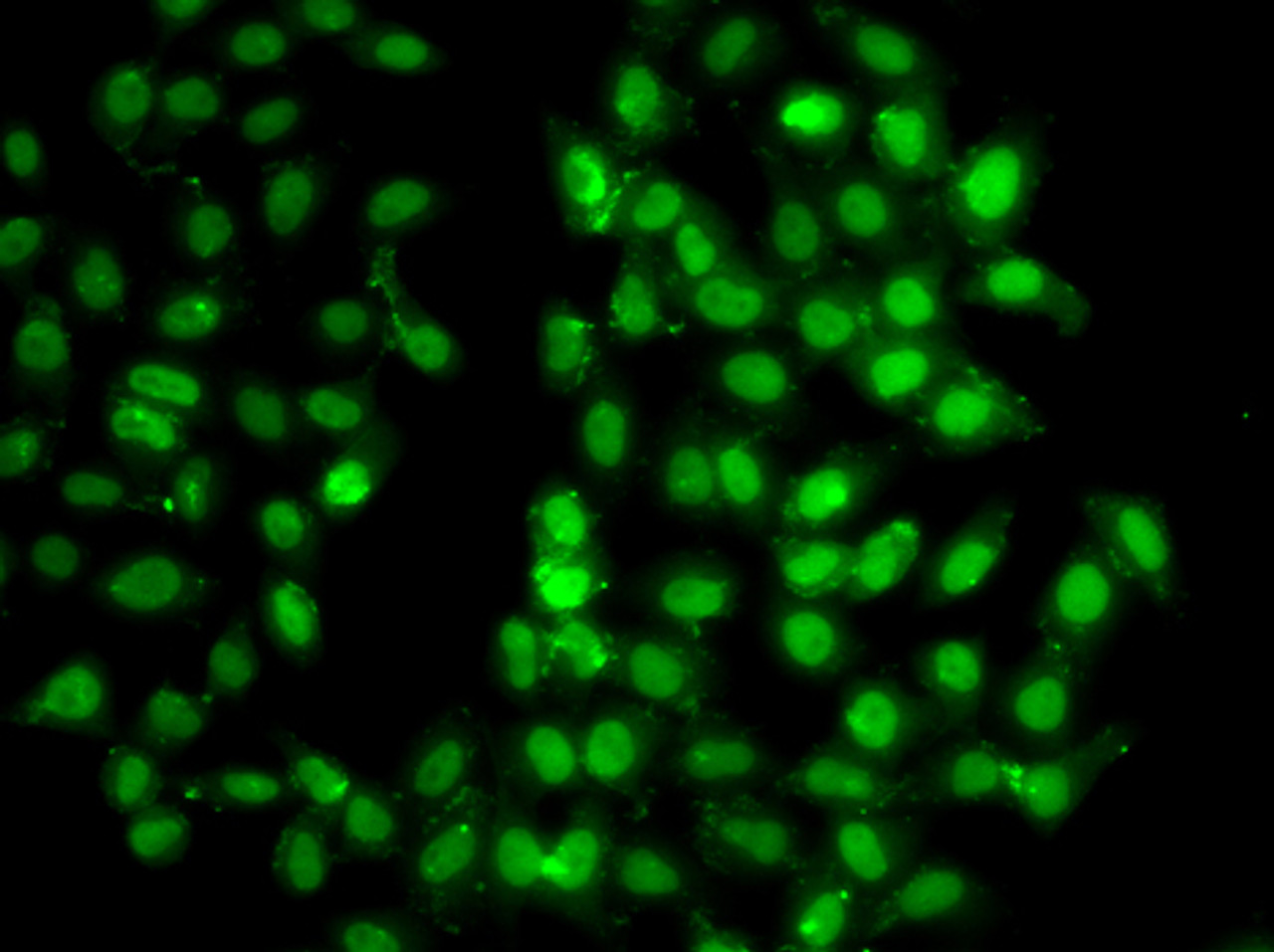 Immunofluorescence analysis of U2OS cells using PSMD8 Polyclonal Antibody