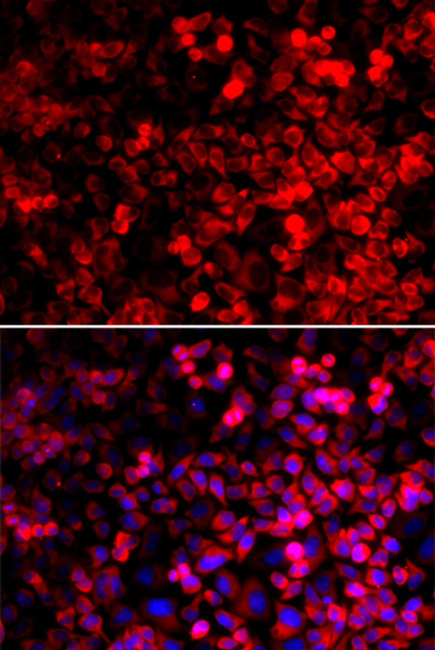 Immunofluorescence analysis of U2OS cells using QARS Polyclonal Antibody