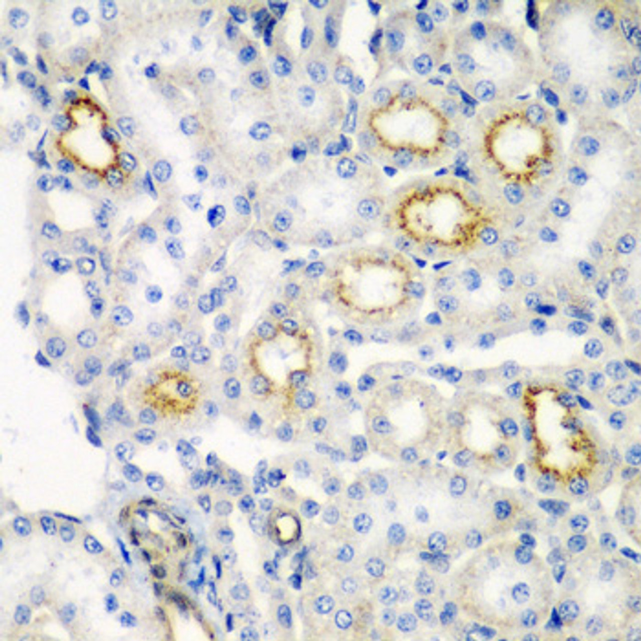 Immunohistochemistry of paraffin-embedded Rat kidney using RARRES2 Polyclonal Antibody at dilution of  1:200 (40x lens).