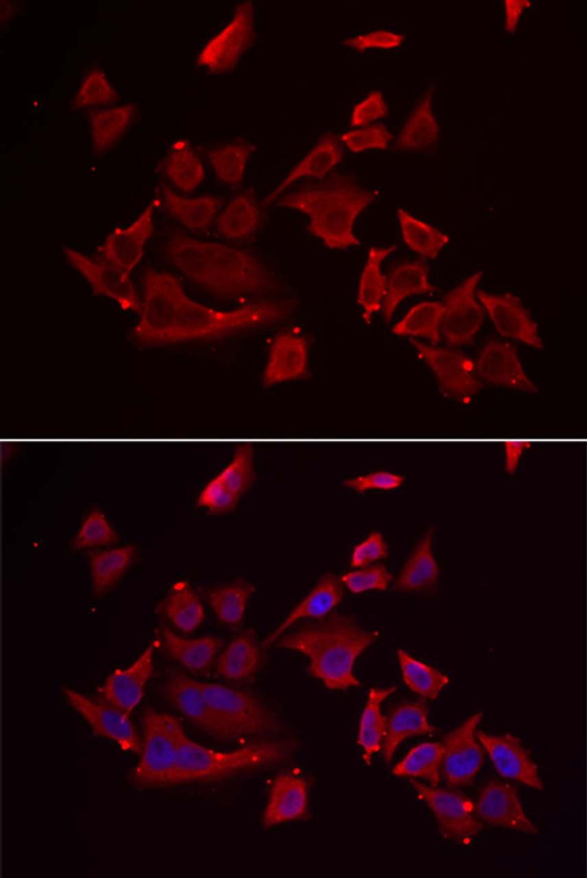 Immunofluorescence analysis of MCF-7 cells using RARRES2 Polyclonal Antibody