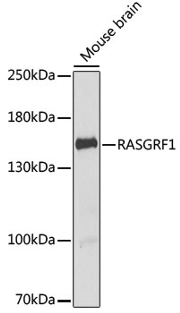 Western blot analysis of extracts of Mouse brain using RASGRF1 Polyclonal Antibody at dilution of 1:1000.