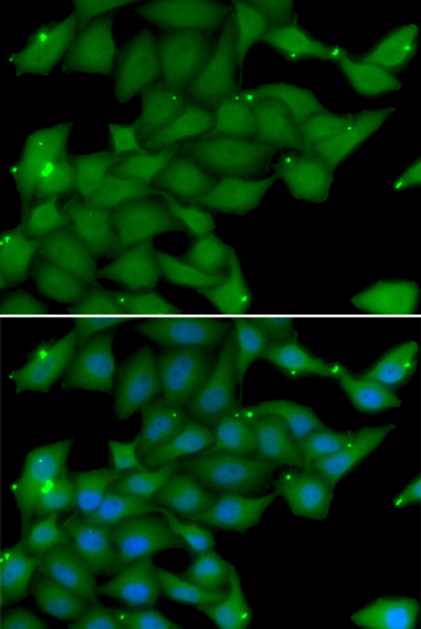 Immunofluorescence analysis of U2OS cells using RASGRF1 Polyclonal Antibody