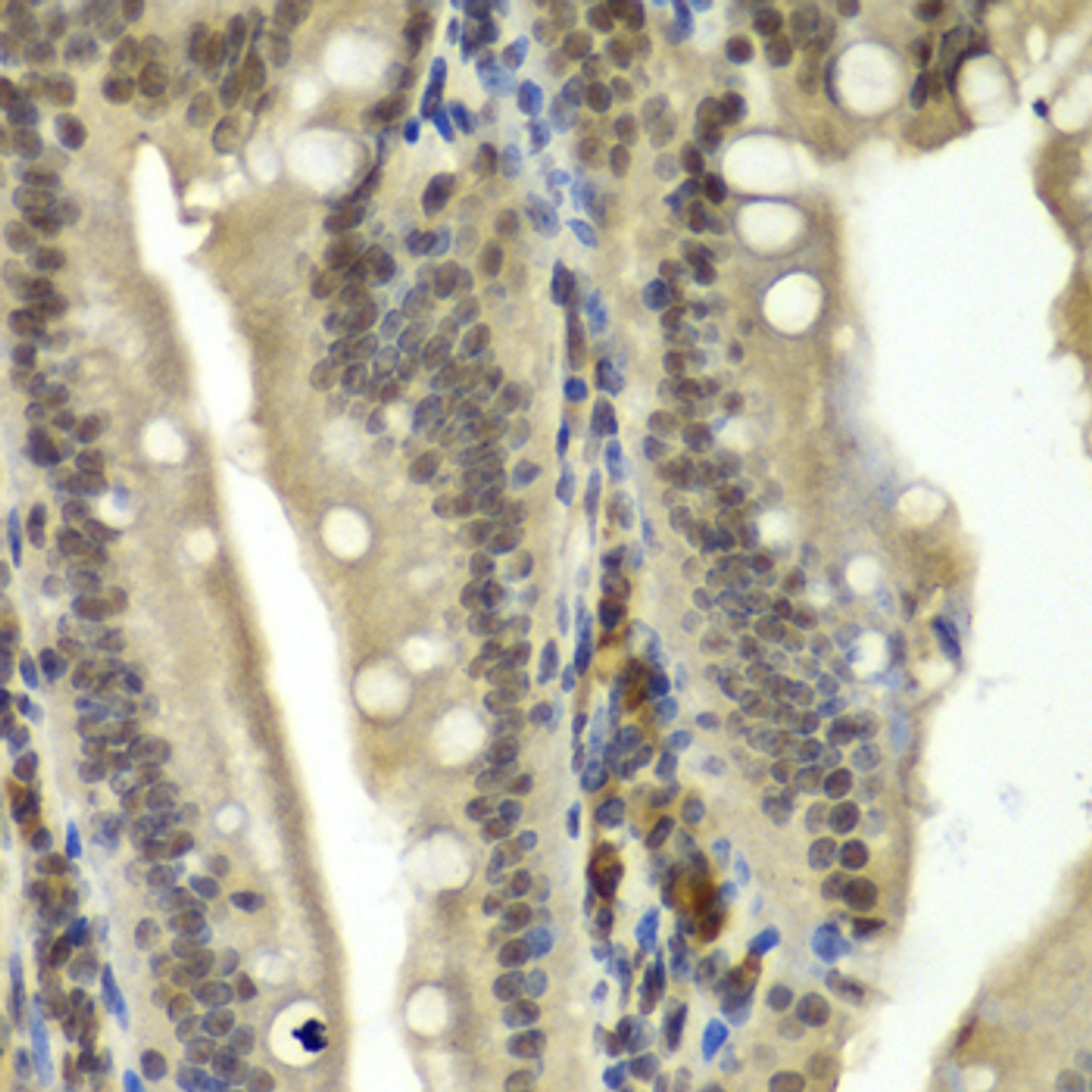 Immunohistochemistry of paraffin-embedded Rat Intestine using RBBP5 Polyclonal Antibody at dilution of  1:100 (40x lens).