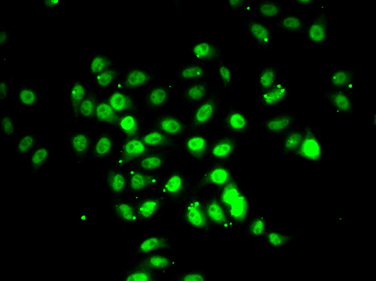 Immunofluorescence analysis of U2OS cells using RFX5 Polyclonal Antibody