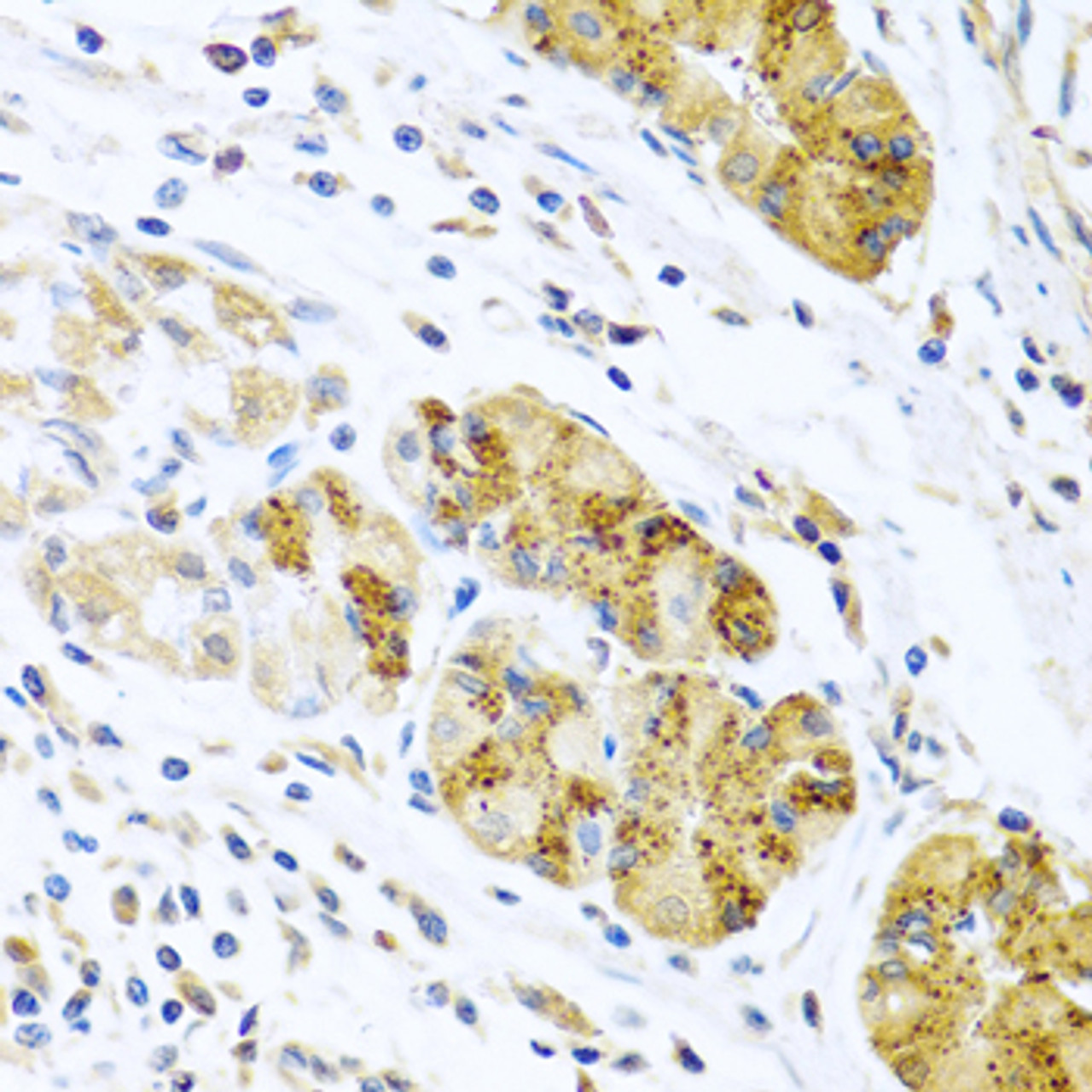 Immunohistochemistry of paraffin-embedded Human stomach using CCL8 Polyclonal Antibody at dilution of  1:100 (40x lens).