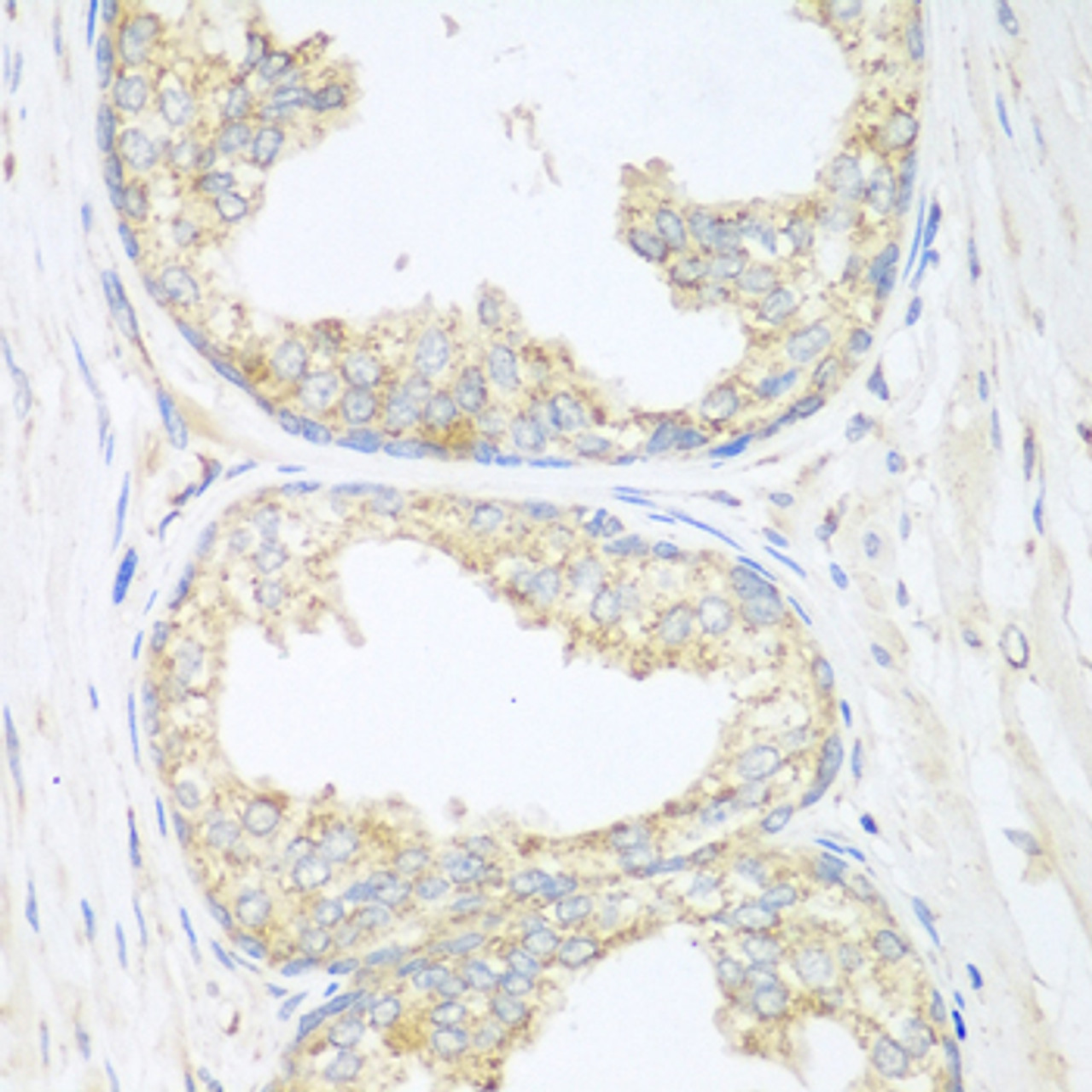 Immunohistochemistry of paraffin-embedded Human prostate using SGCB Polyclonal Antibody at dilution of  1:100 (40x lens).