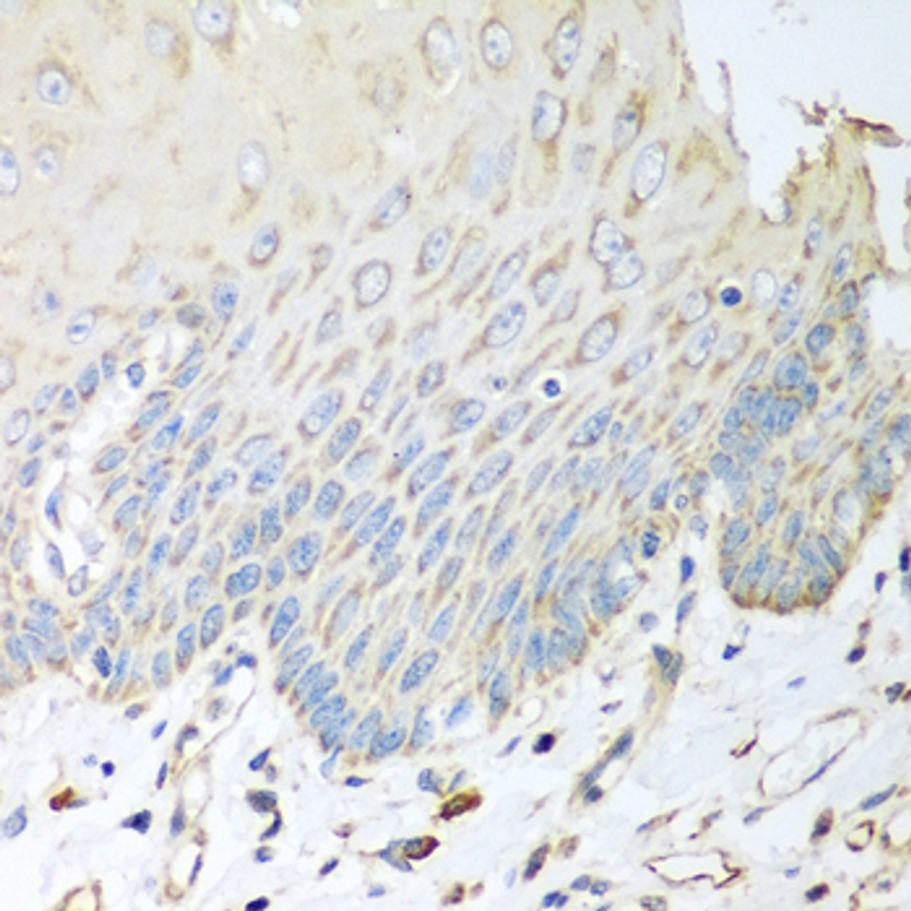 Immunohistochemistry of paraffin-embedded Human esophagus using SGCB Polyclonal Antibody at dilution of  1:100 (40x lens).