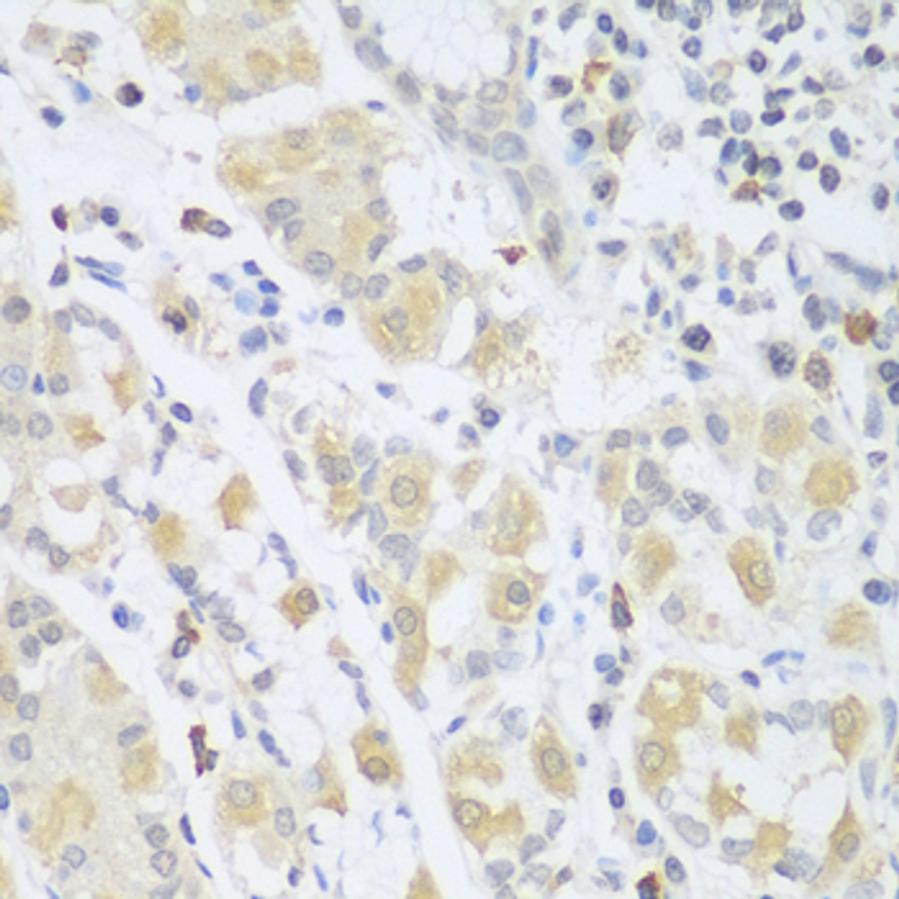 Immunohistochemistry of paraffin-embedded Human stomach using SGCB Polyclonal Antibody at dilution of  1:100 (40x lens).