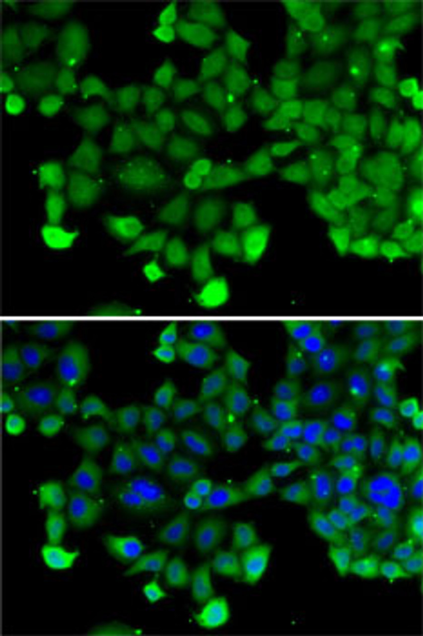 Immunofluorescence analysis of A-549 cells using SNRPD2 Polyclonal Antibody