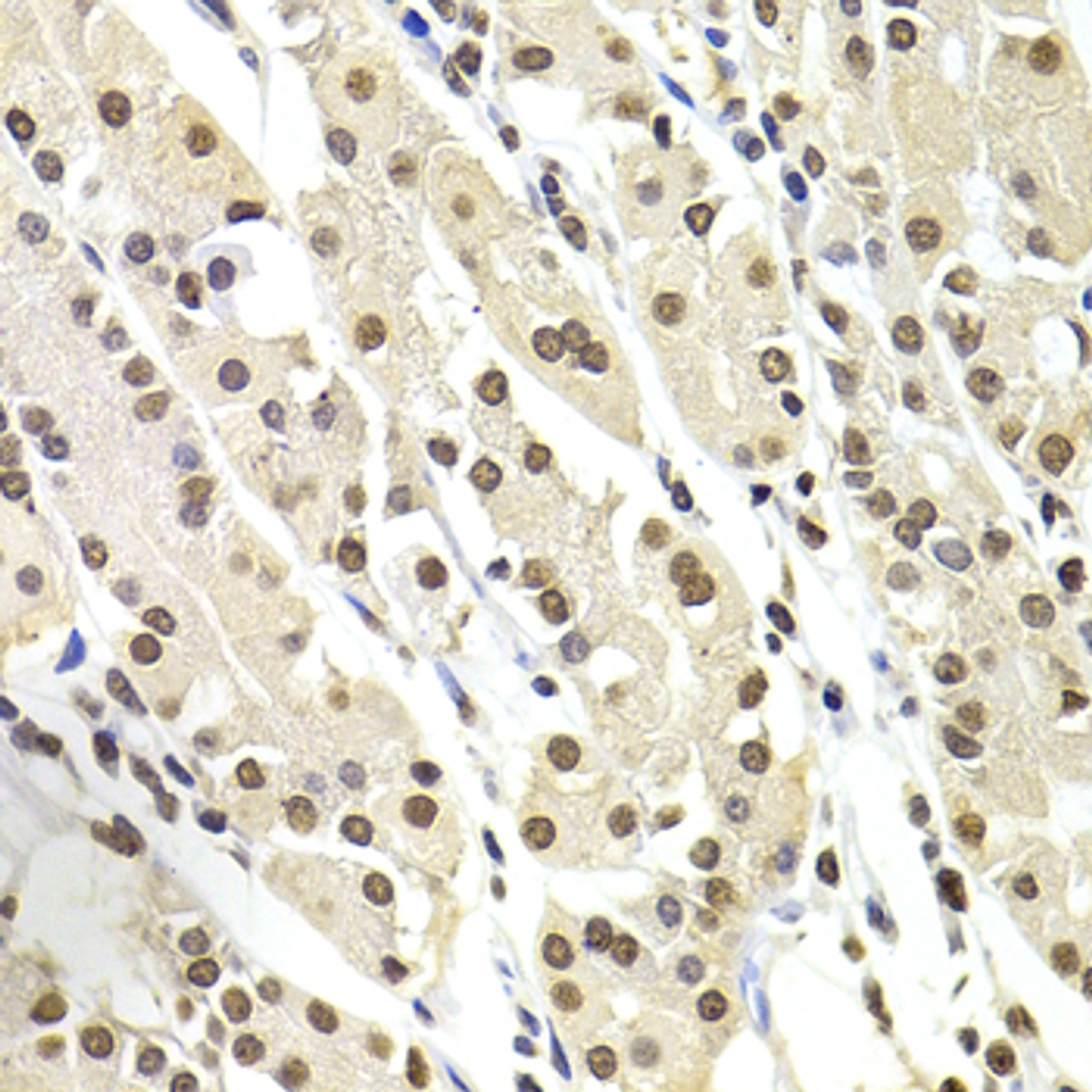 Immunohistochemistry of paraffin-embedded Human stomach using SOX5 Polyclonal Antibody at dilution of  1:100 (40x lens).
