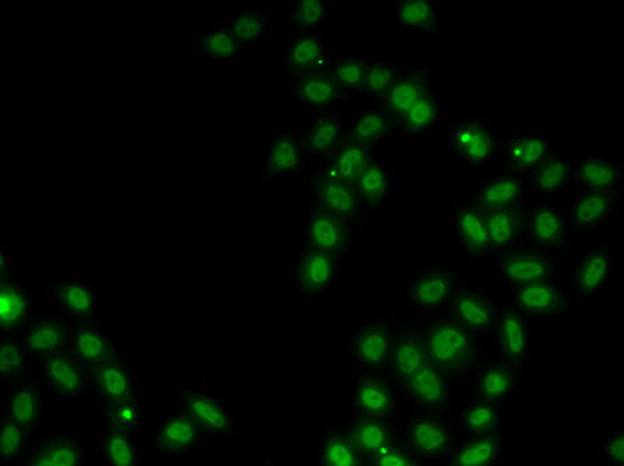 Immunofluorescence analysis of MCF7 cells using SOX5 Polyclonal Antibody