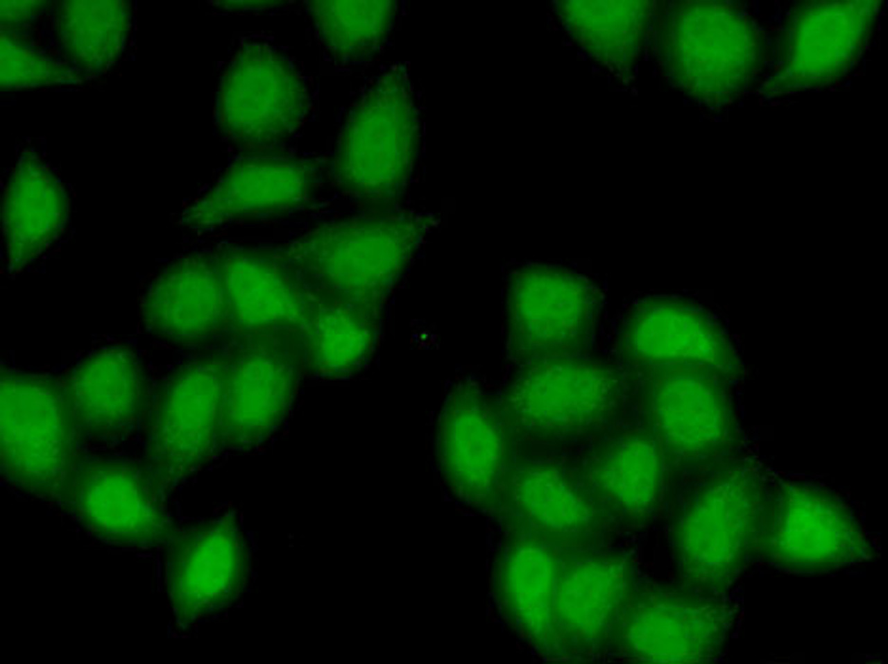 Immunofluorescence analysis of MCF7 cells using SS18 Polyclonal Antibody
