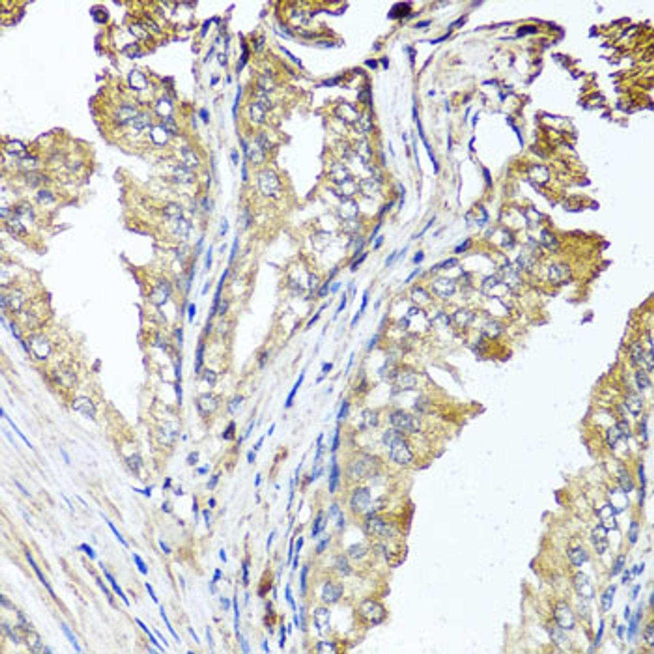 Immunohistochemistry of paraffin-embedded Human prostate using STK3 Polyclonal Antibody at dilution of  1:100 (40x lens).