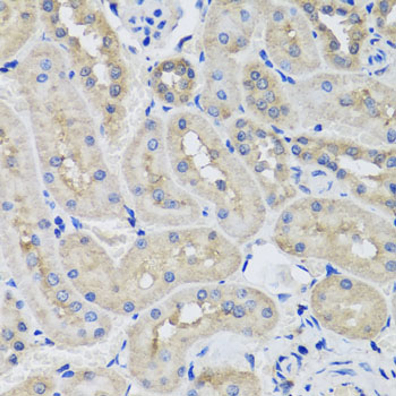 Immunohistochemistry of paraffin-embedded Rat kidney using STK3 Polyclonal Antibody at dilution of  1:100 (40x lens).