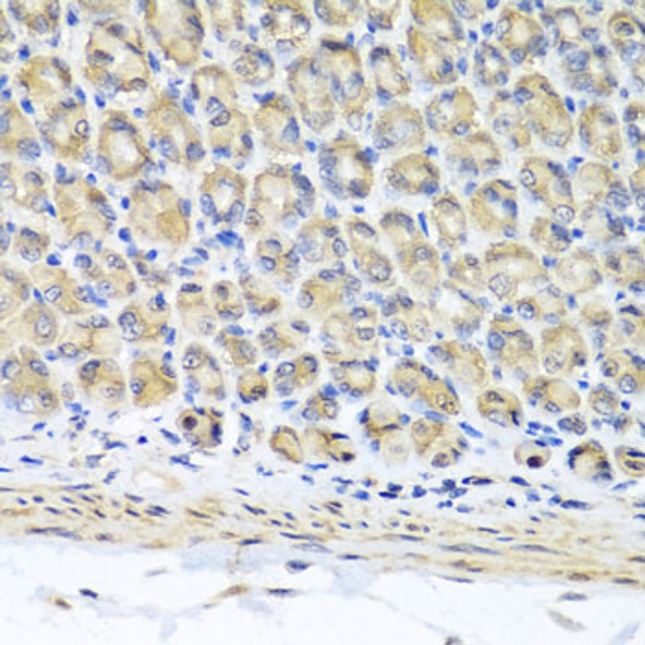 Immunohistochemistry of paraffin-embedded Mouse stomach using STK3 Polyclonal Antibody at dilution of  1:100 (40x lens).
