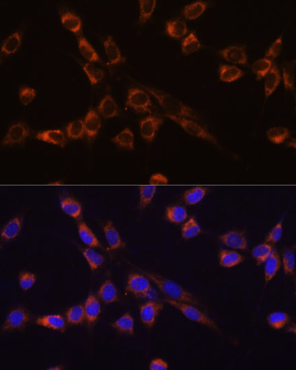 Immunofluorescence analysis of NIH-3T3 cells using STK3 Polyclonal Antibody at dilution of  1:100 (40x lens). Blue: DAPI for nuclear staining.
