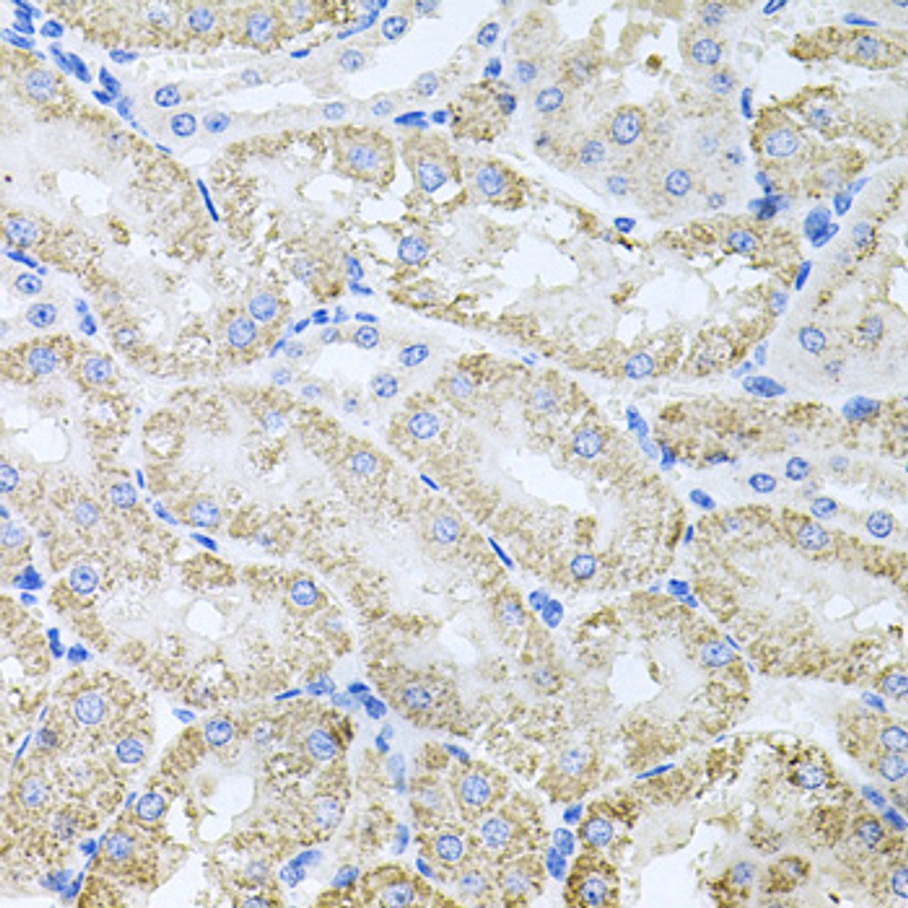Immunohistochemistry of paraffin-embedded Mouse kidney using TARS Polyclonal Antibody at dilution of  1:100 (40x lens).
