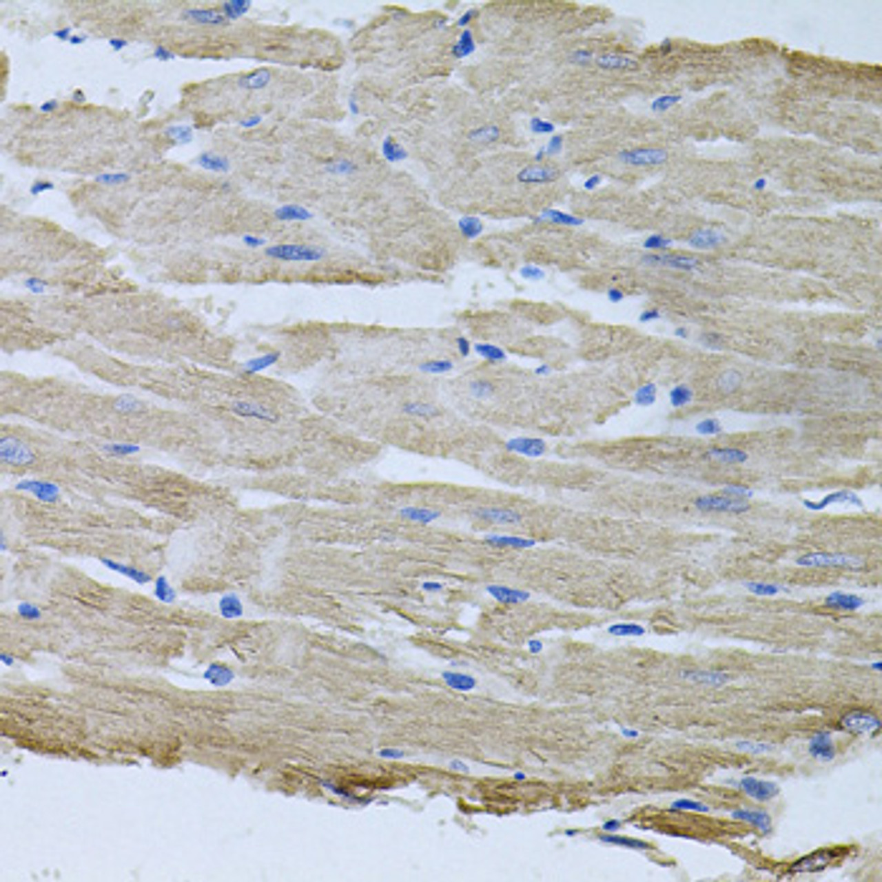 Immunohistochemistry of paraffin-embedded Rat heart using TARS Polyclonal Antibody at dilution of  1:100 (40x lens).