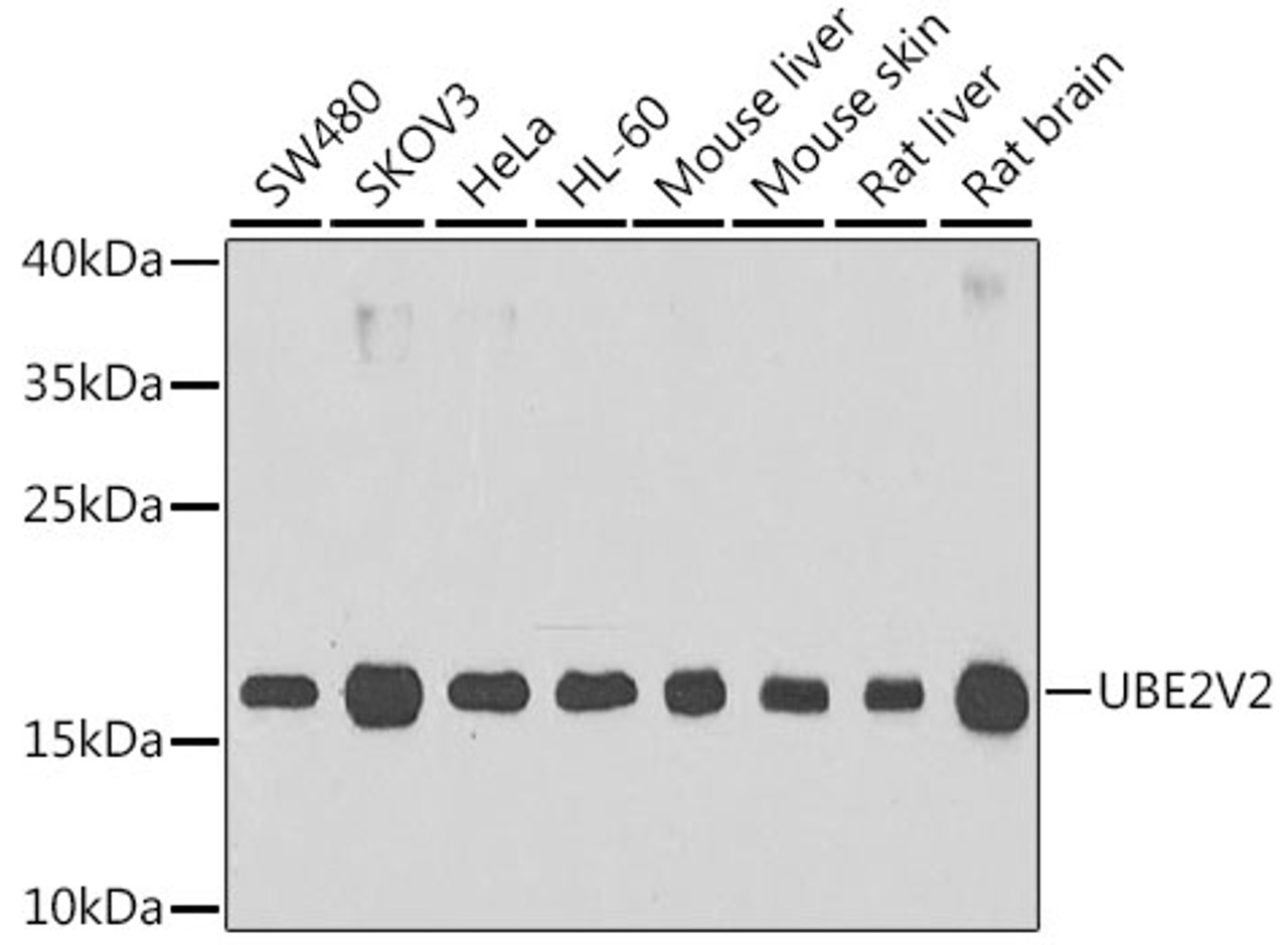 Western blot analysis of extracts of various cell lines using UBE2V2 Polyclonal Antibody at dilution of 1:1000.
