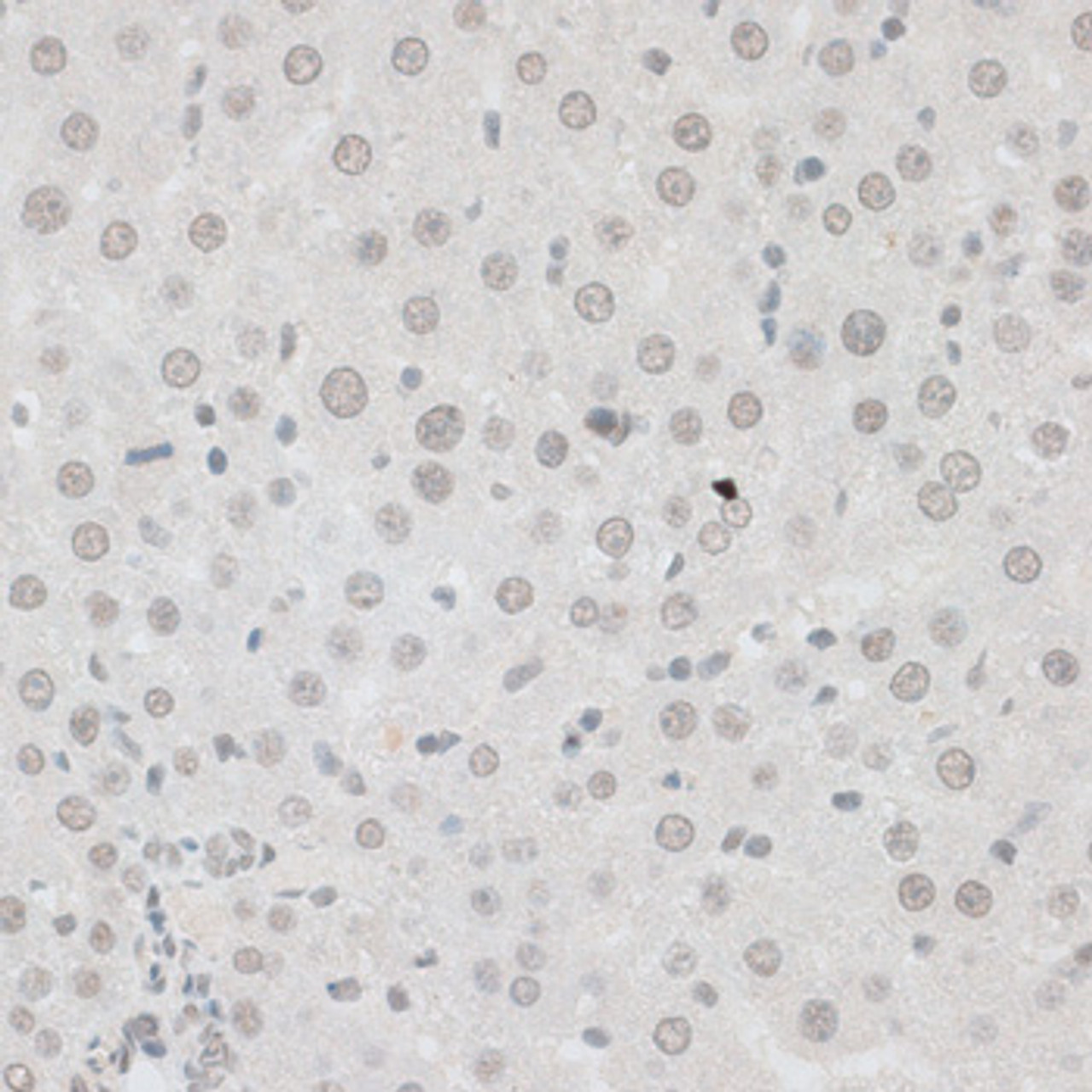 Immunohistochemistry of paraffin-embedded Rat liver using ZNF148 Polyclonal Antibody at dilution of  1:100 (40x lens).