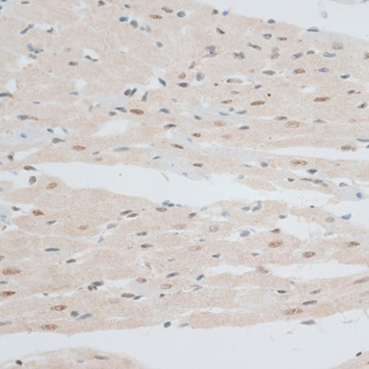 Immunohistochemistry of paraffin-embedded Rat heart using ZNF148 Polyclonal Antibody at dilution of  1:100 (40x lens).