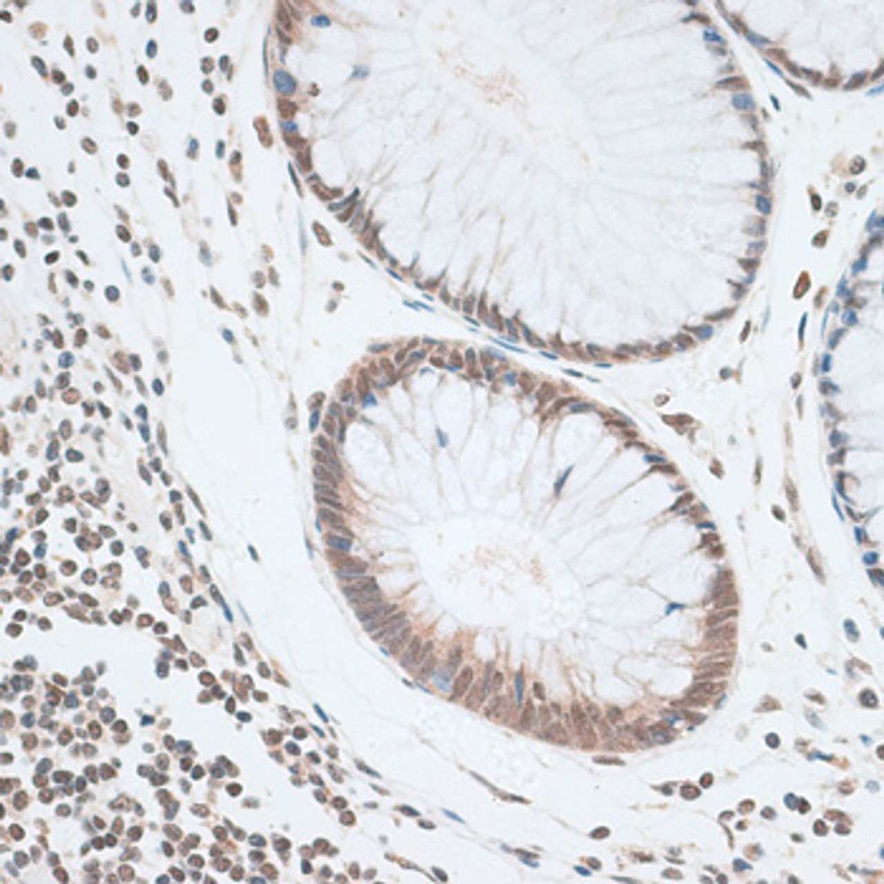 Immunohistochemistry of paraffin-embedded Human colon using ZNF148 Polyclonal Antibody at dilution of  1:100 (40x lens).