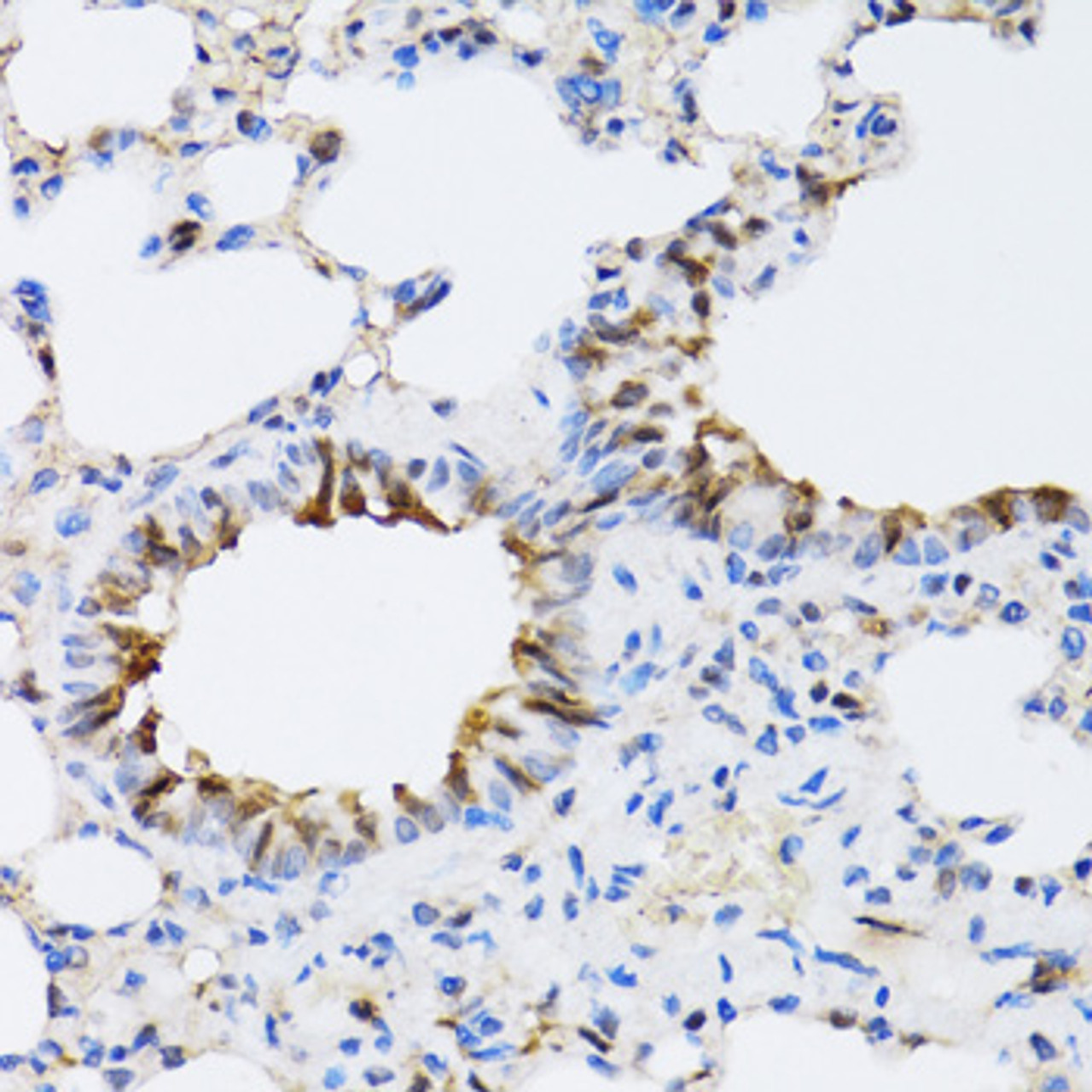 Immunohistochemistry of paraffin-embedded Rat lung using NAA10 Polyclonal Antibody at dilution of  1:100 (40x lens).