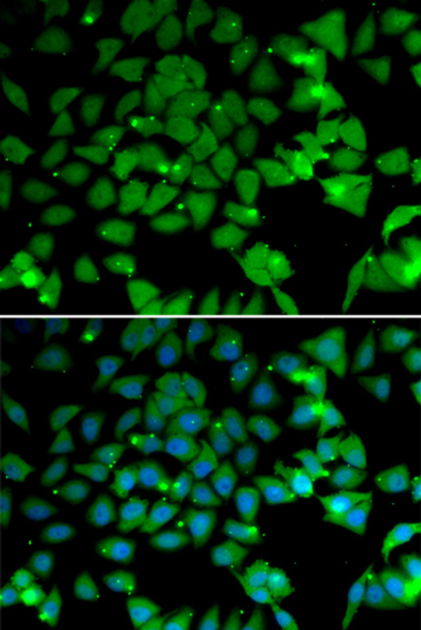 Immunofluorescence analysis of U2OS cells using NAA10 Polyclonal Antibody