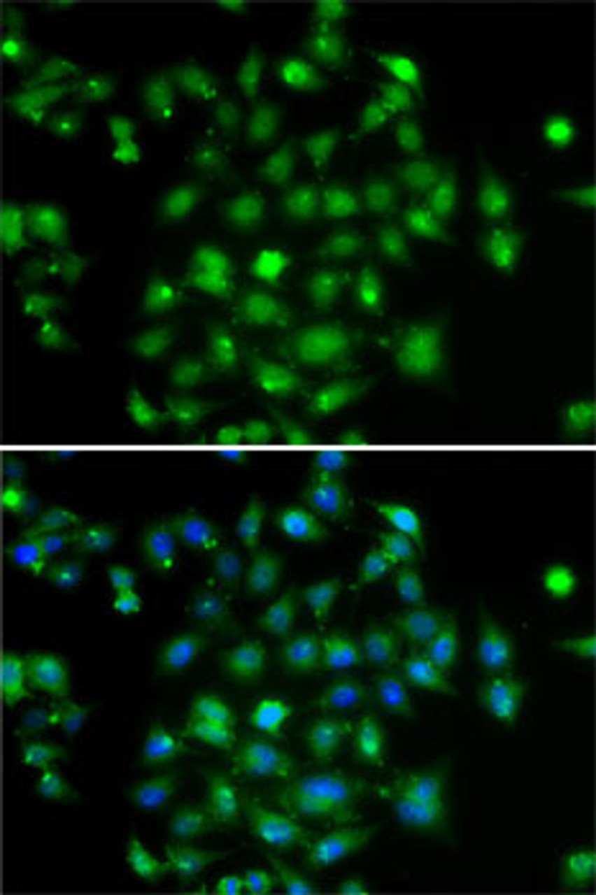 Immunofluorescence analysis of A-549 cells using DYRK2 Polyclonal Antibody