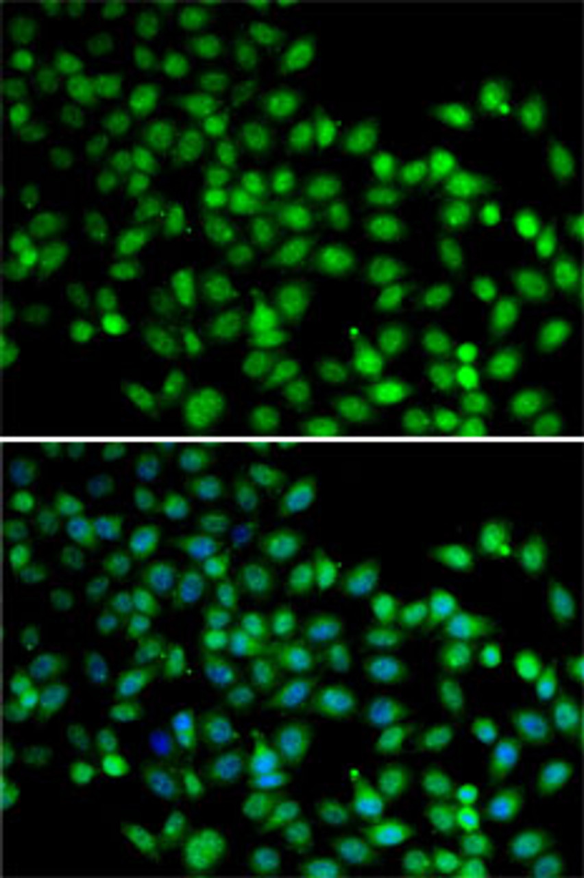Immunofluorescence analysis of A-549 cells using FKBP6 Polyclonal Antibody