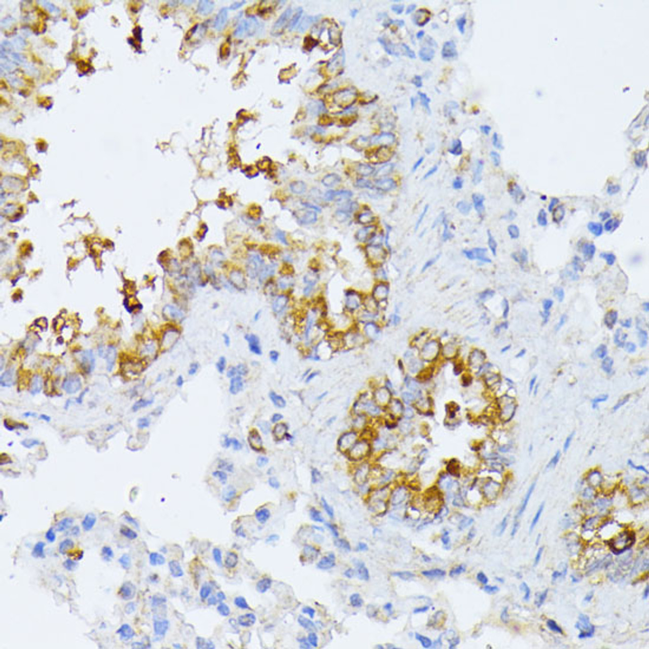 Immunohistochemistry of paraffin-embedded Rat lung using EIF2B2 Polyclonal Antibody at dilution of  1:100 (40x lens).