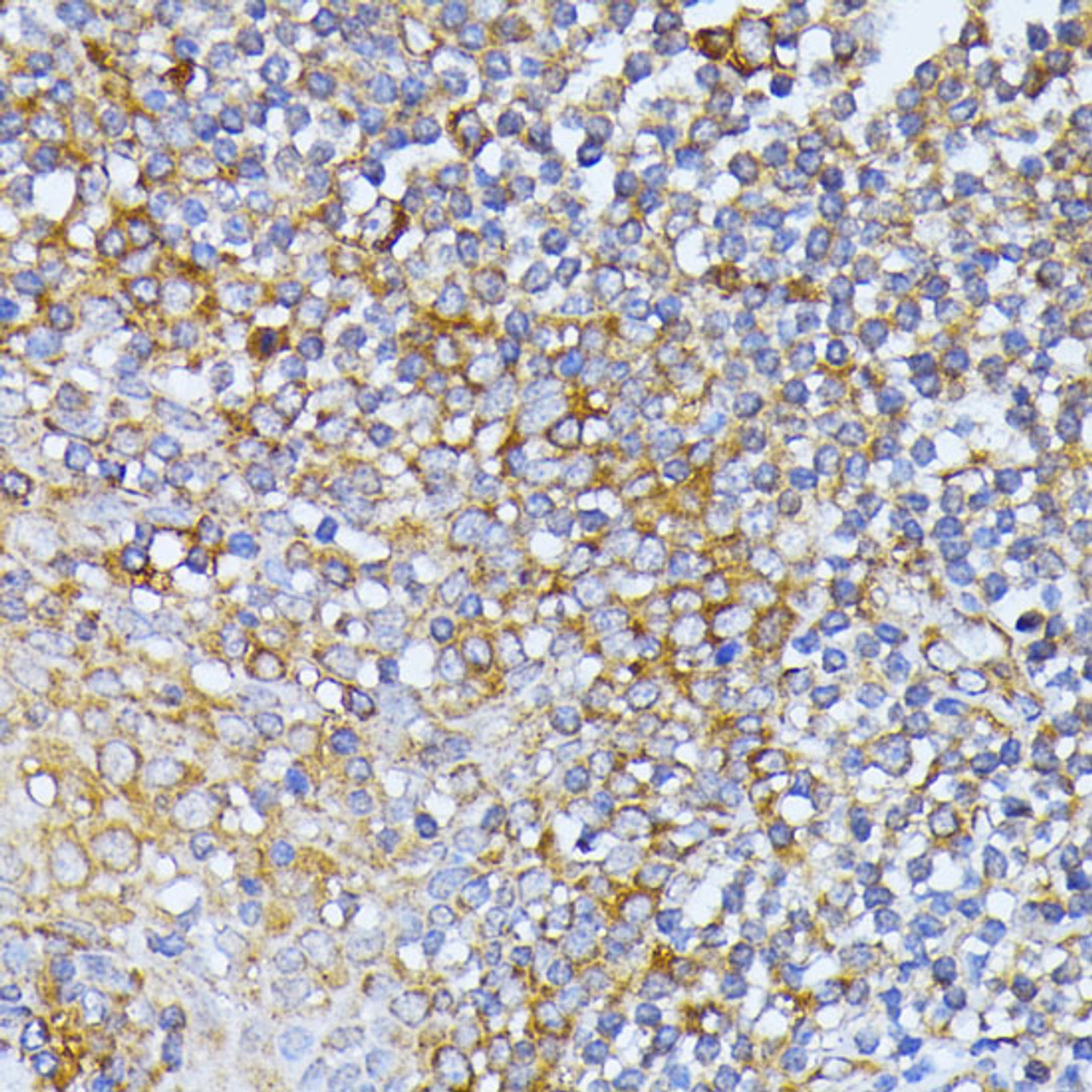 Immunohistochemistry of paraffin-embedded Human tonsil using EIF2B2 Polyclonal Antibody at dilution of  1:100 (40x lens).