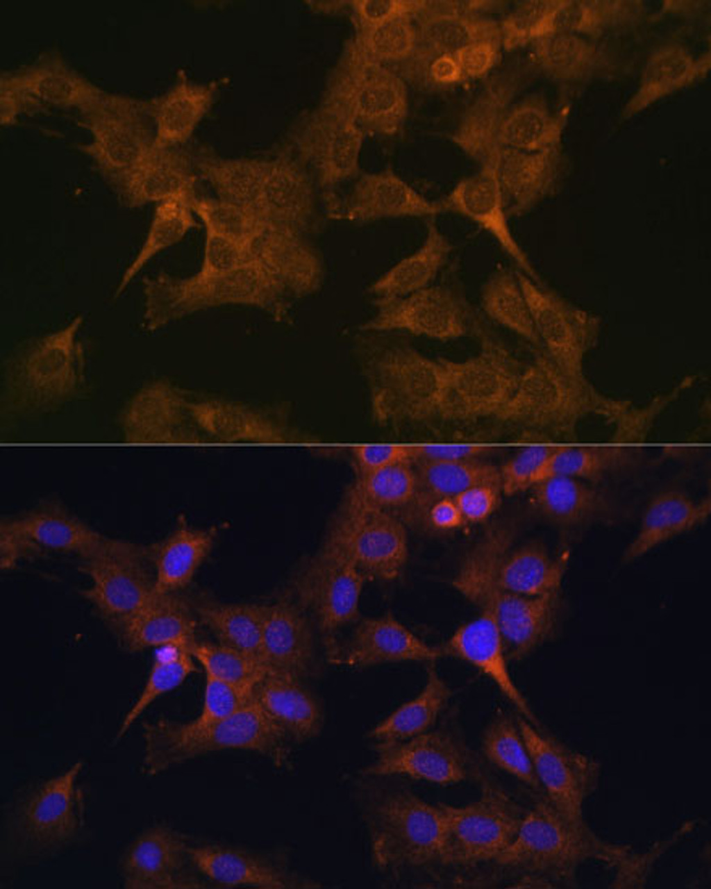 Immunofluorescence analysis of C6 cells using EIF2B2 Polyclonal Antibody at dilution of  1:100. Blue: DAPI for nuclear staining.