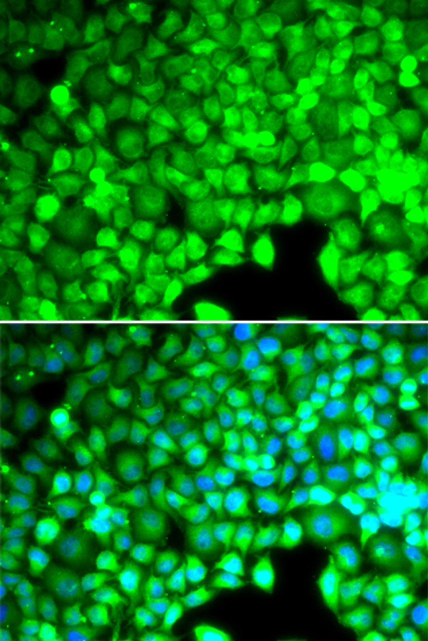 Immunofluorescence analysis of U2OS cells using CYTH2 Polyclonal Antibody