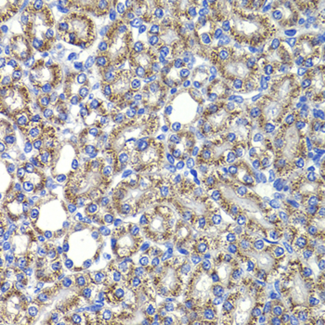 Immunohistochemistry of paraffin-embedded Rat kidney using COPS2 Polyclonal Antibody at dilution of  1:100 (40x lens).