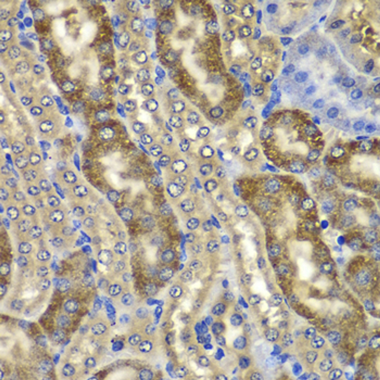 Immunohistochemistry of paraffin-embedded Mouse kidney using NMT2 Polyclonal Antibody at dilution of  1:100 (40x lens).