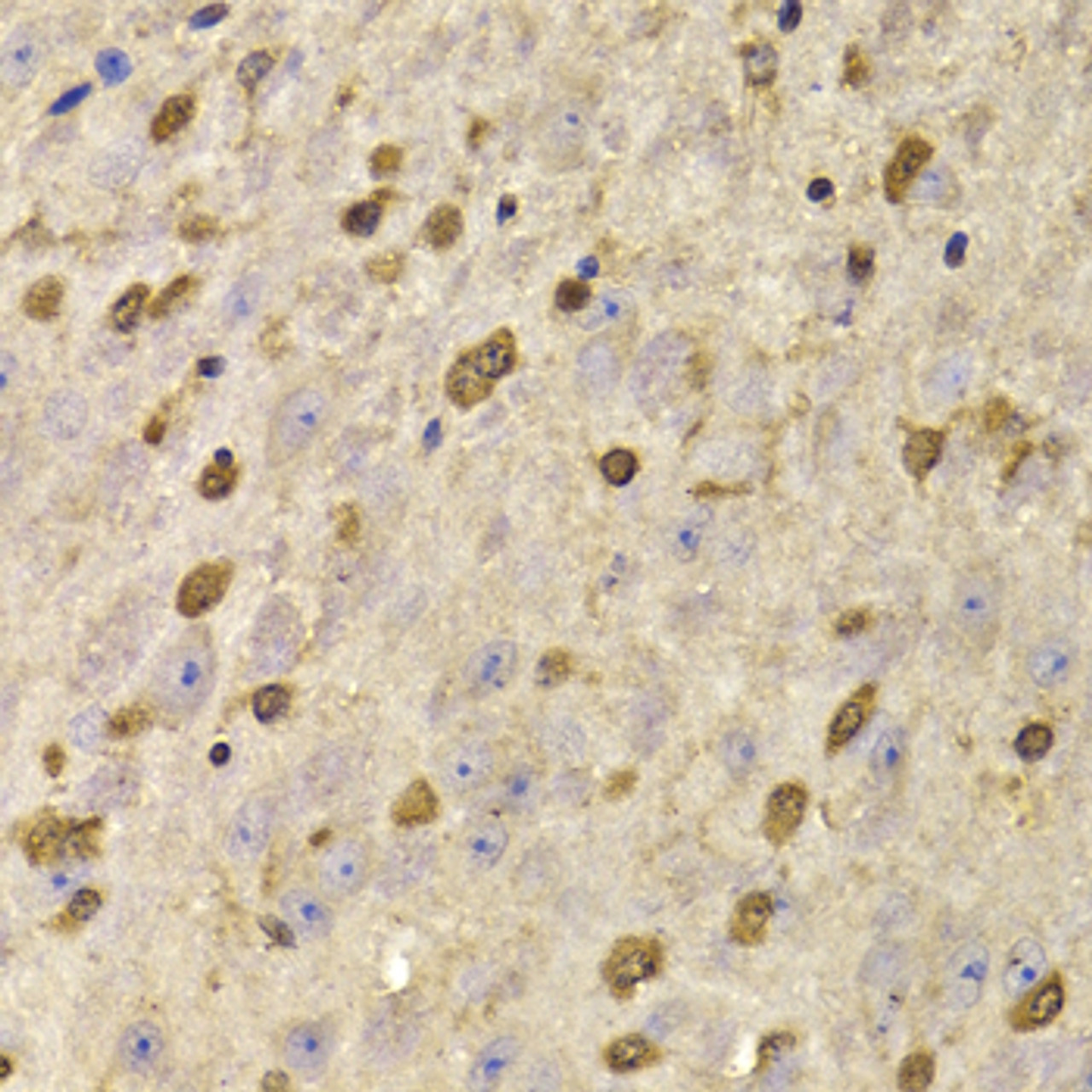 Immunohistochemistry of paraffin-embedded Mouse brain using QKI Polyclonal Antibody at dilution of  1:100 (40x lens).