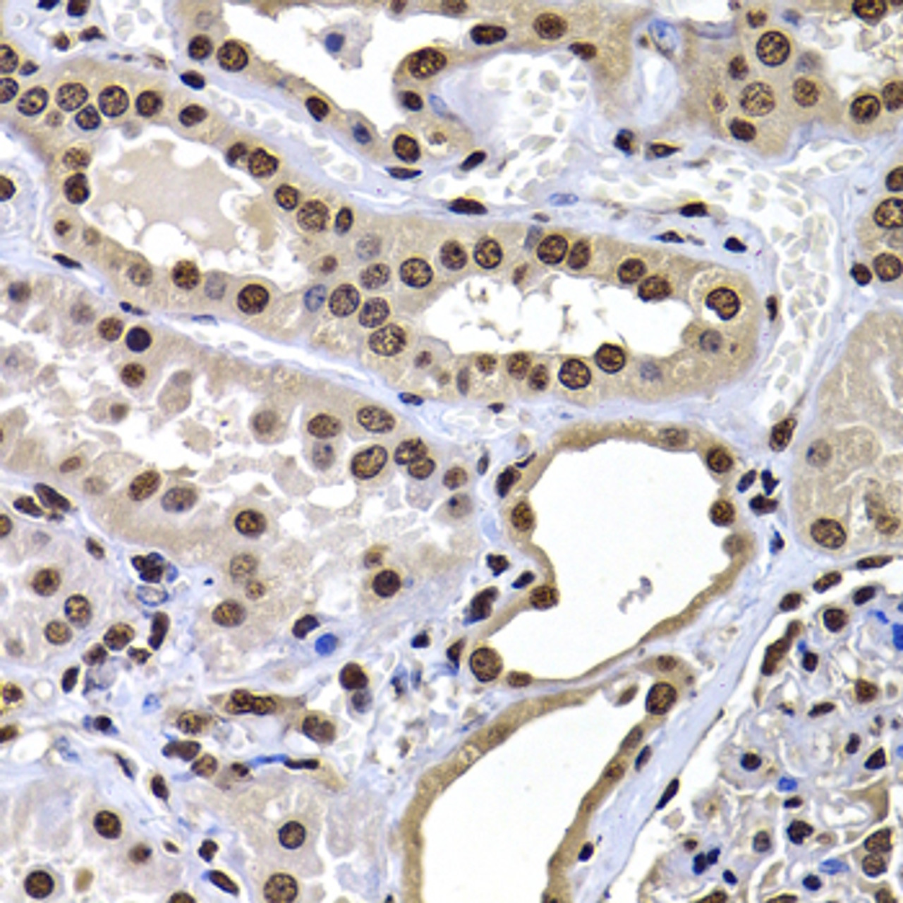 Immunohistochemistry of paraffin-embedded Human kidney using mH2A1 Polyclonal Antibody at dilution of  1:100 (40x lens).