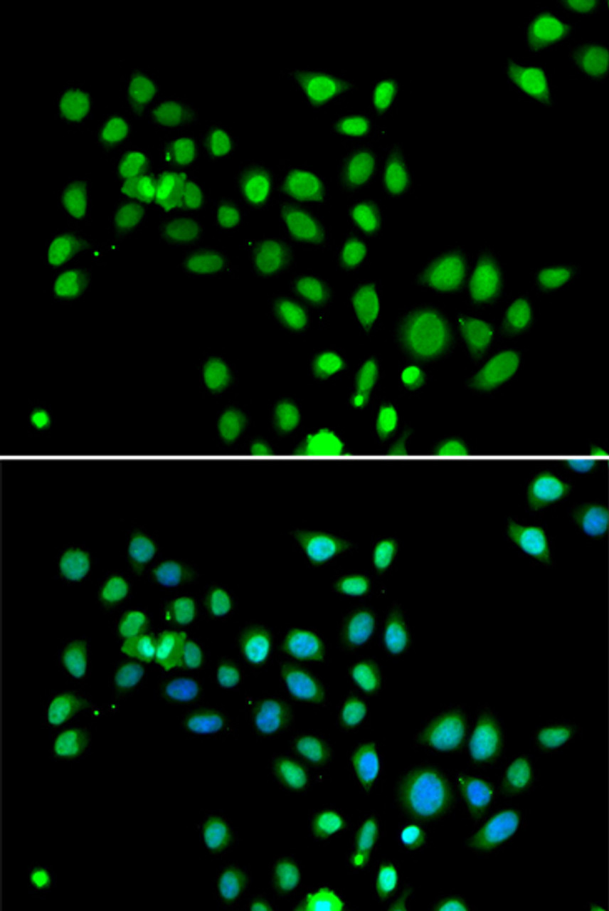 Immunofluorescence analysis of U2OS cells using mH2A1 Polyclonal Antibody