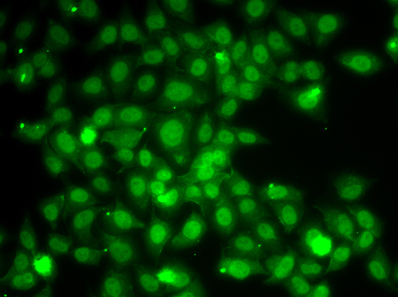 Immunofluorescence analysis of A549 cells using TRAF4 Polyclonal Antibody