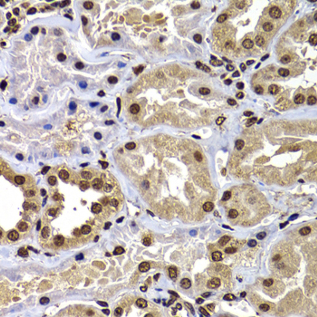 Immunohistochemistry of paraffin-embedded Human kidney using DNAJB6 Polyclonal Antibody at dilution of  1:100 (40x lens).