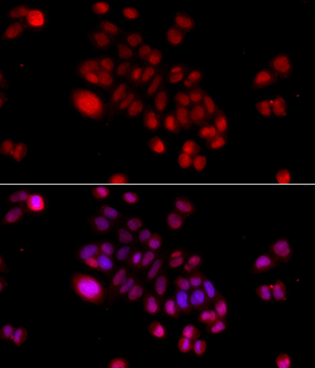 Immunofluorescence analysis of HeLa cells using DNAJB6 Polyclonal Antibody at dilution of  1:100 (40x lens). Blue: DAPI for nuclear staining.