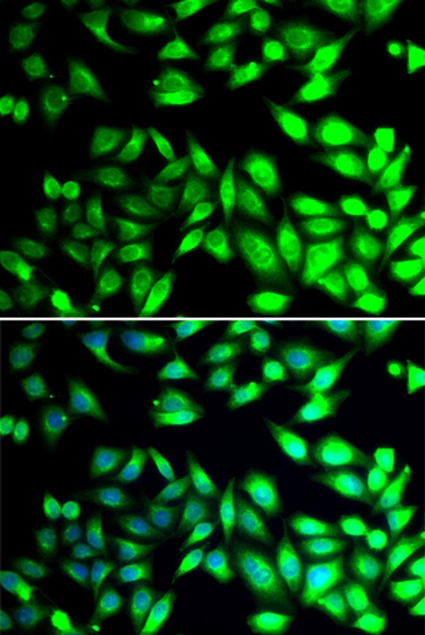 Immunofluorescence analysis of U2OS cells using PDIA6 Polyclonal Antibody